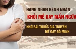 Bài thuốc mề đay Đỗ Minh giúp hàng ngàn người thoát khỏi dị ứng, mề đay mẩn ngứa