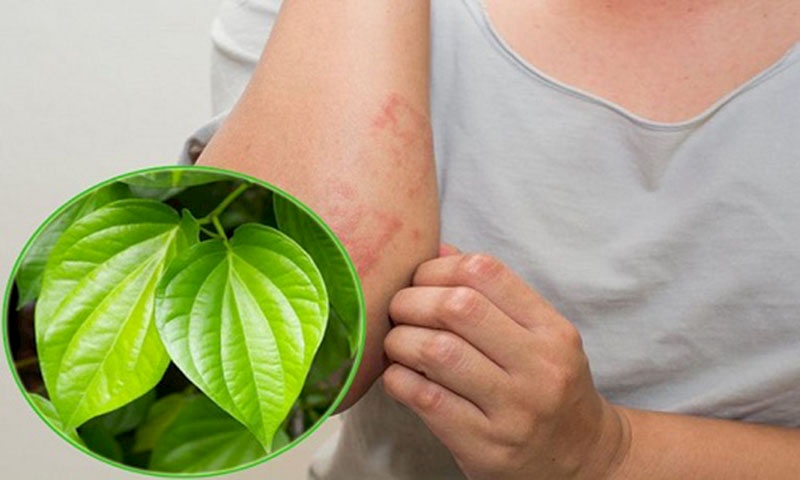Mẹo chữa mề đay bằng lá trầu không cực đơn giản Mẹo chữa mề đay bằng lá trầu không cực đơn giản