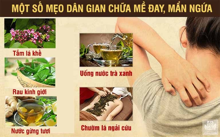Một số mẹo dân gian chữa mề đay hiệu quả các bạn có thể thực hiện tại nhà Một số mẹo dân gian chữa mề đay hiệu quả các bạn có thể thực hiện tại nhà