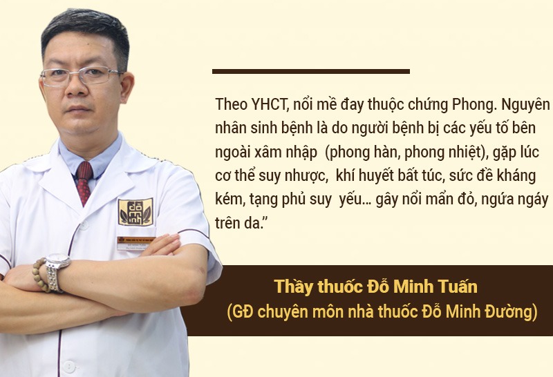 Lương y Đỗ Minh Tuấn chia sẻ nguyên nhân mề đay mẩn ngứa