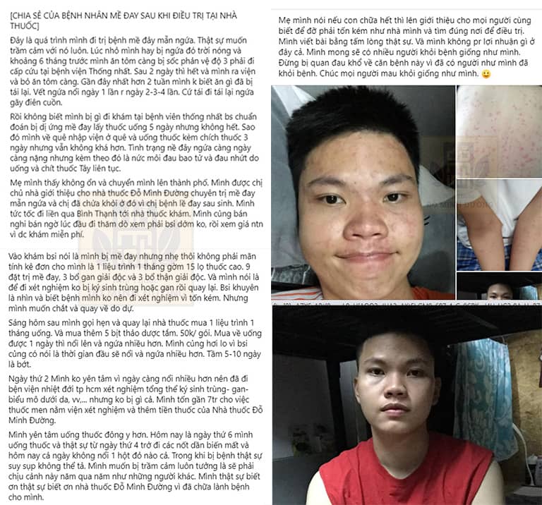 Một số phản hồi của người bệnh về hiệu quả bài thuốc Mề đay Đỗ Minh