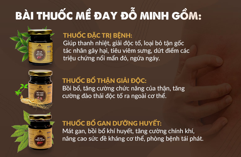 Hiệu quả vượt trội của liệu trình "3 trong 1" bài thuốc Mề đay Đỗ Minh